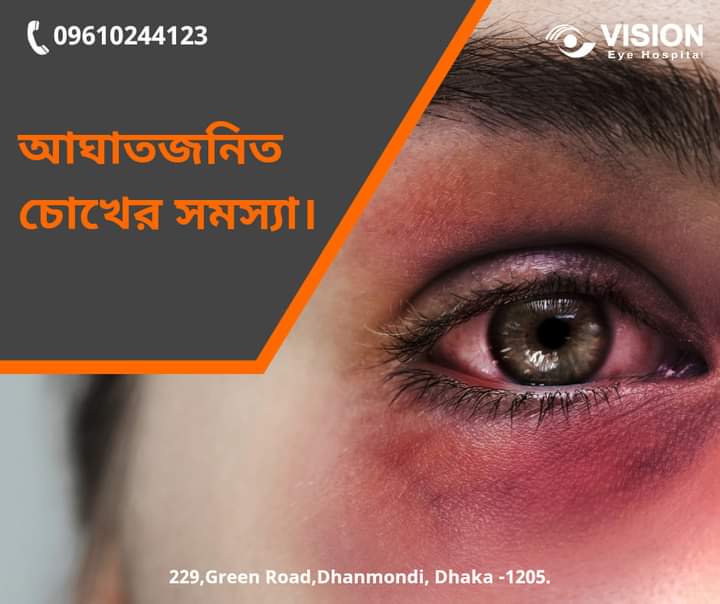 আঘাতজনিত চোখের সমস্যা।