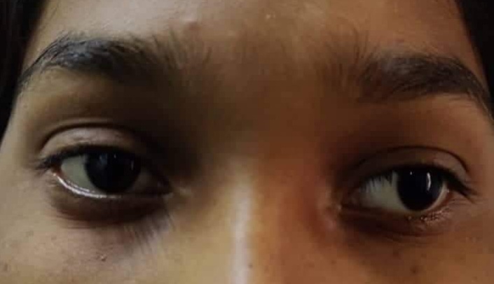 সুমির অনেক মন খারাপ।।