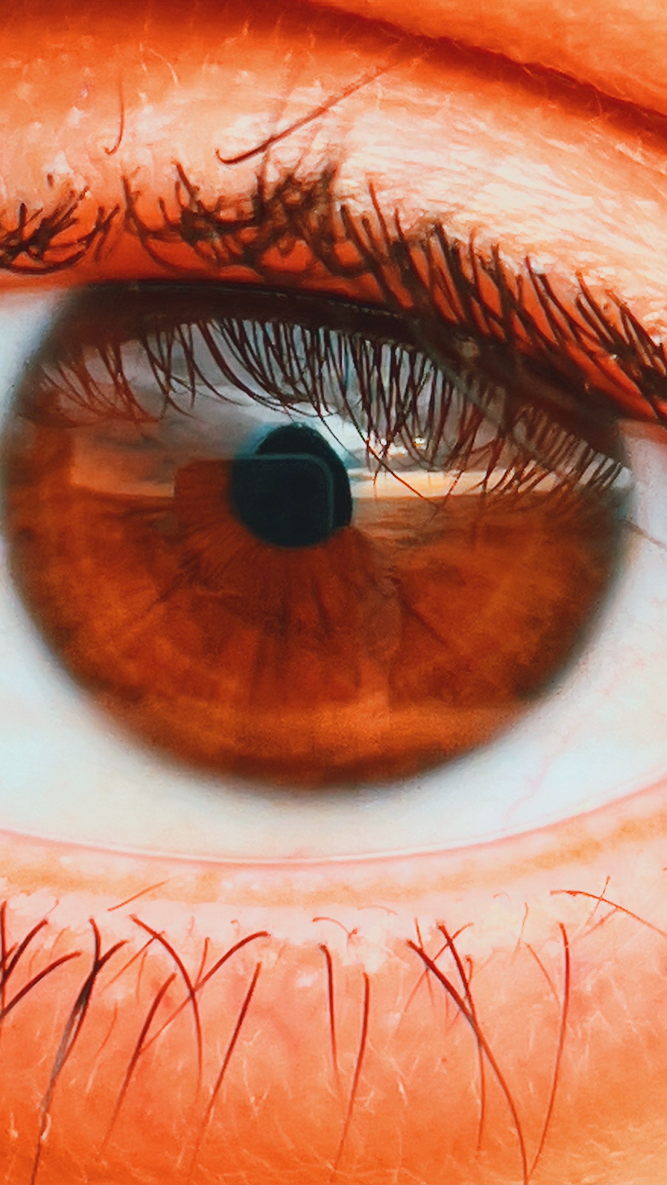 Very Rare Eye Disorders You Must Know