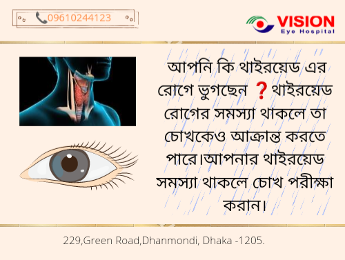 আপনার যদি থাইরয়েডের সমস্যা থাকে তাহলে চোখ পরীক্ষা করান।