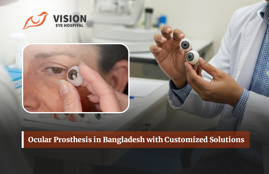 Ocular Prosthesis in Bangladesh with Customized Solutions