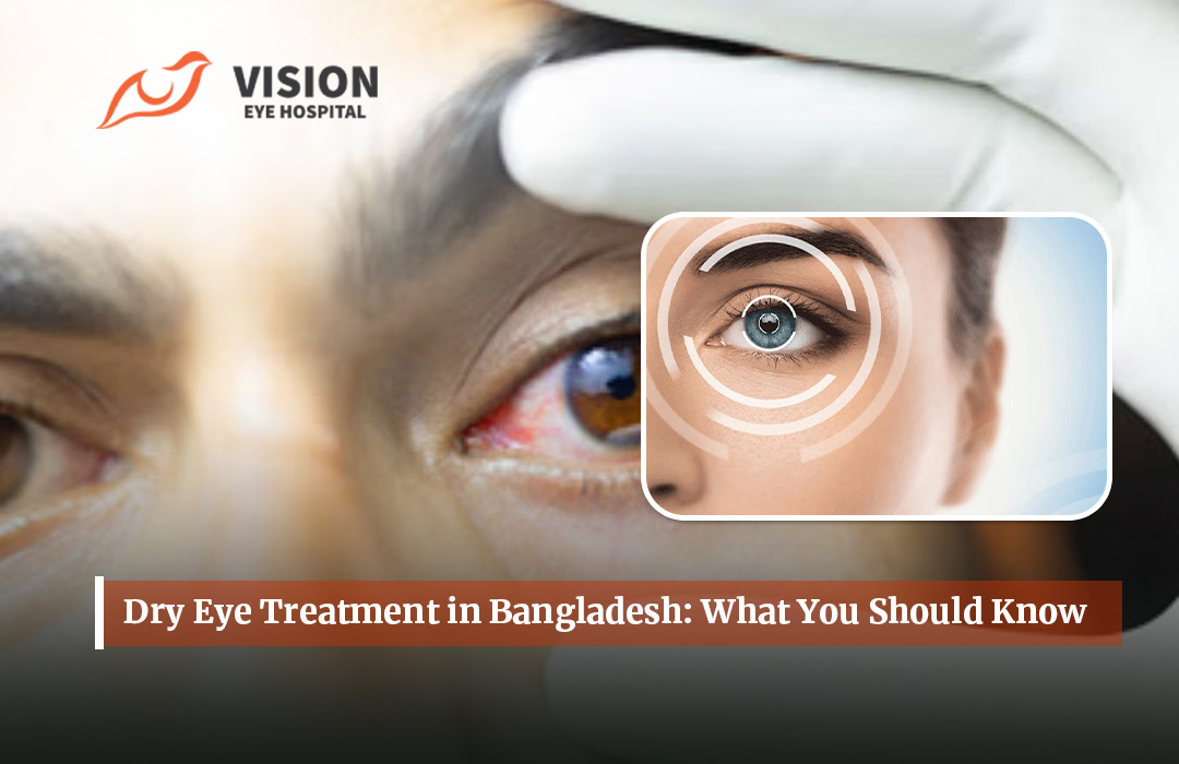 Dry Eye Problem in Bangladesh: Causes, Symptoms & Modern Treatment