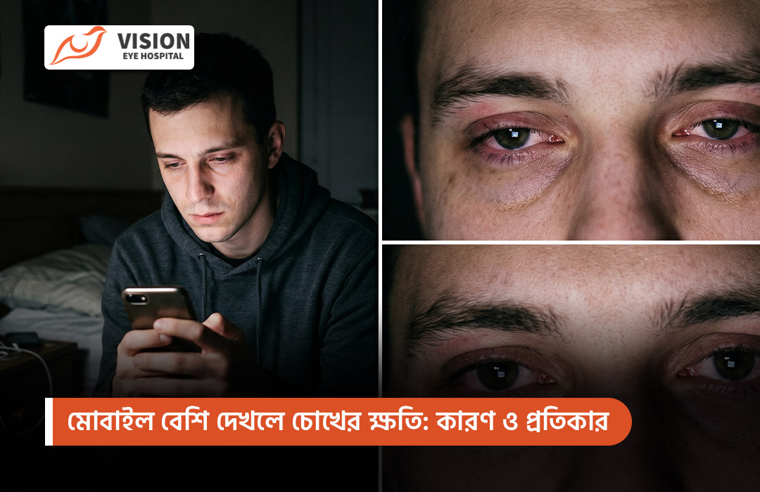 মোবাইল বেশি দেখলে চোখের ক্ষতি: কারণ ও প্রতিকার