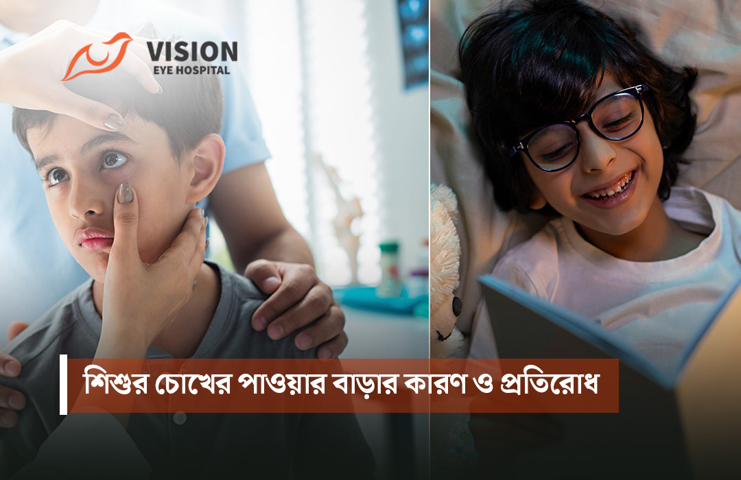 শিশুর চোখের পাওয়ার বাড়ার কারণ ও প্রতিরোধ
