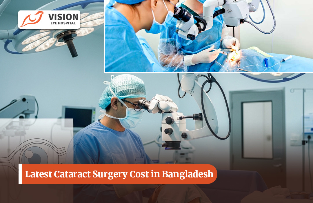 Latest Cataract Surgery Cost in Bangladesh