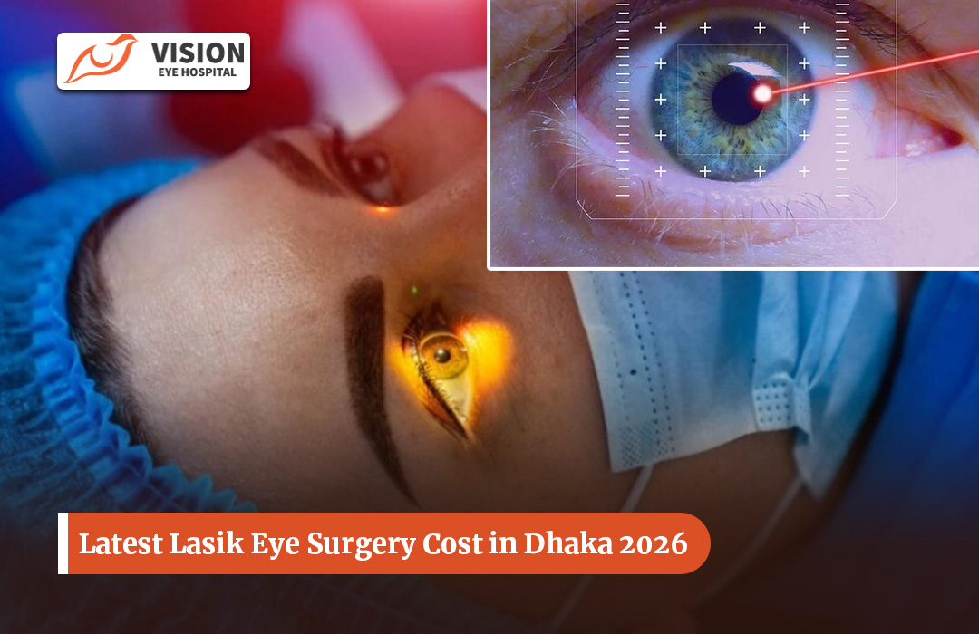 Latest Lasik Eye Surgery Cost in Dhaka 2026