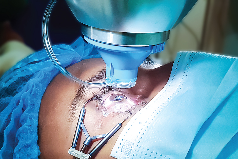 REFRACTIVE SURGERY (LASIK/SMILE/ICL/IPCL)